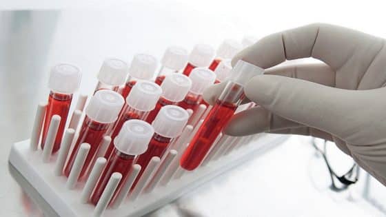 مخاوف عالمية من انتشار متحور جديد في الصين